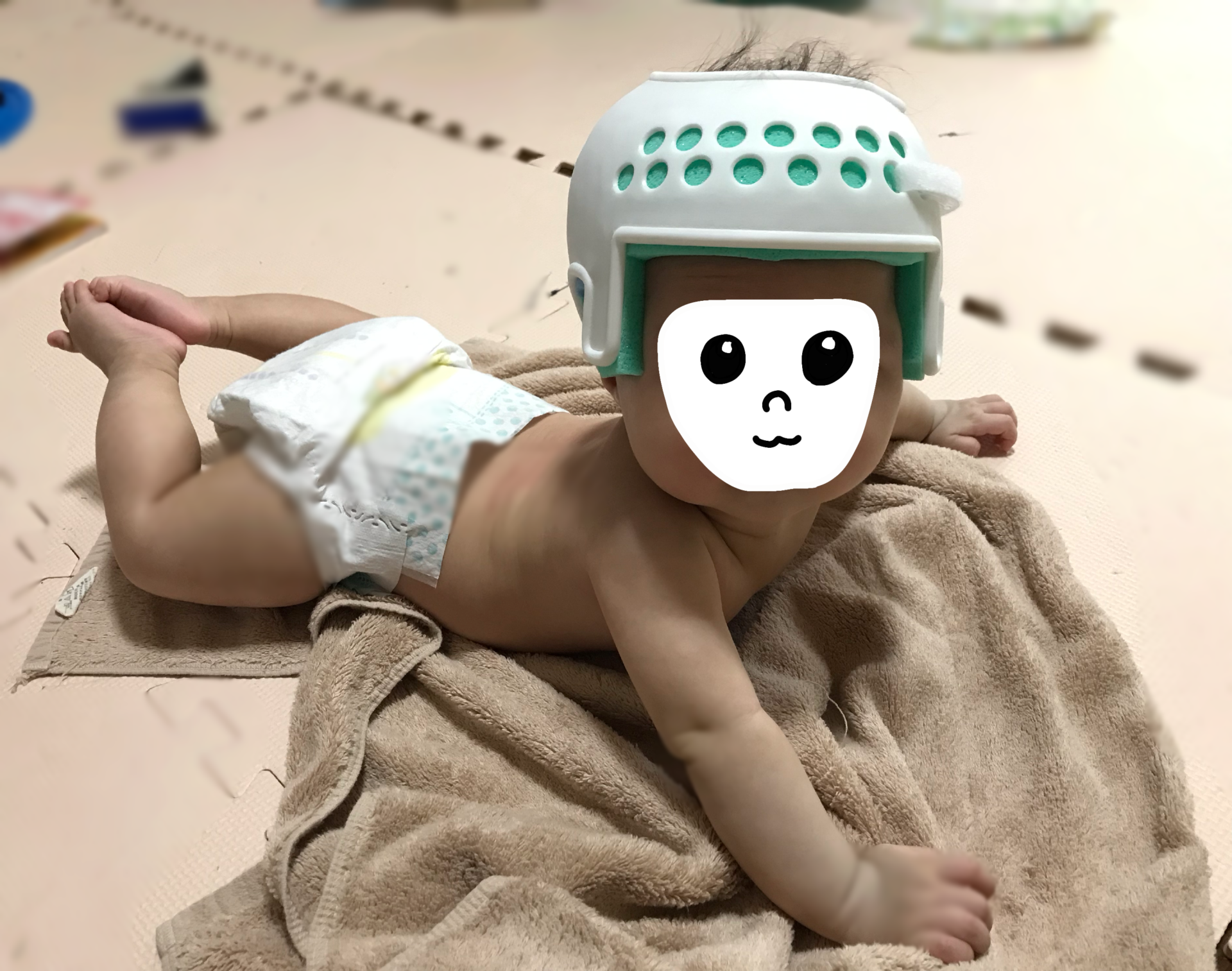 生後5か月ヘルメット装着