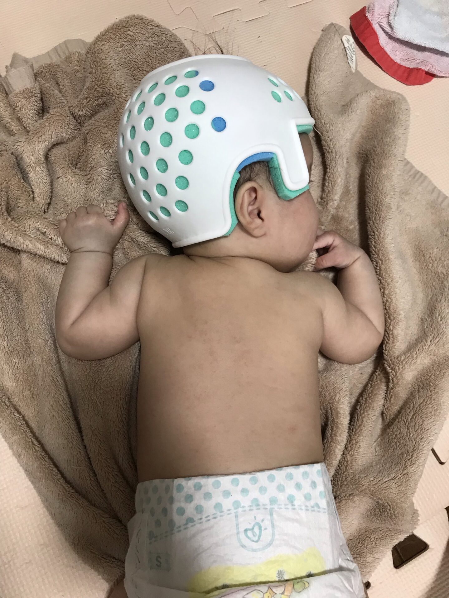 生後5か月ヘルメット装着