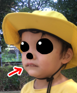 口が閉じない